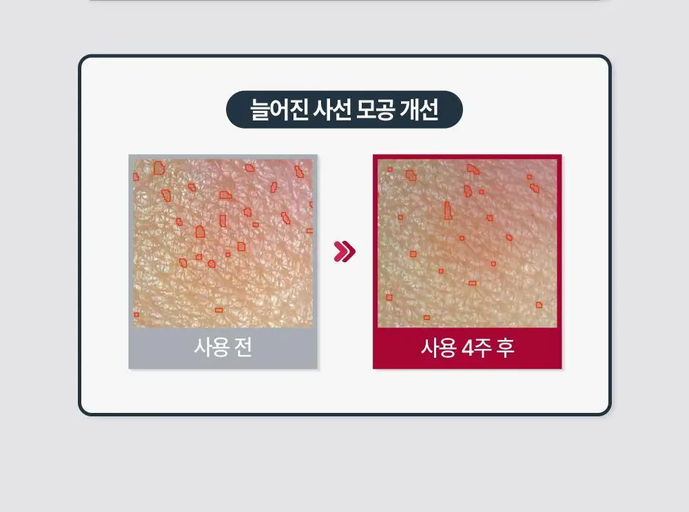 [6주모공세럼] 유세린 하이알루론 3X 컨센트레이트 5ml*6 상세페이지 15